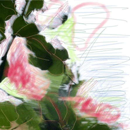 Medizinfotografie Auftragsfotografie Naturfotografie, bypass - Fotobüro Renate Schütz