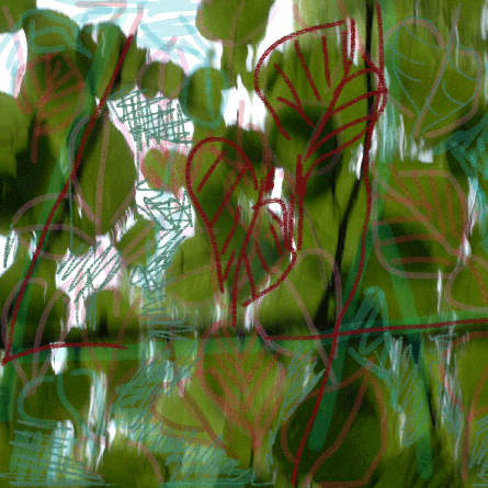 Medizinfotografie Auftragsfotografie Naturfotografie, bypass - Fotobüro Renate Schütz