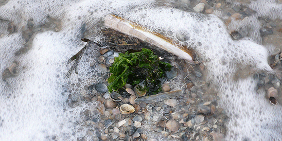 Medizinfotografie Auftragsfotografie Naturfotografie, bypass - Fotobüro Renate Schütz