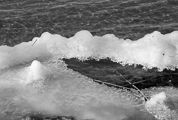 Medizinfotografie Auftragsfotografie Naturfotografie, bypass - Fotobüro Renate Schütz