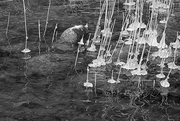 Medizinfotografie Auftragsfotografie Naturfotografie, bypass - Fotobüro Renate Schütz